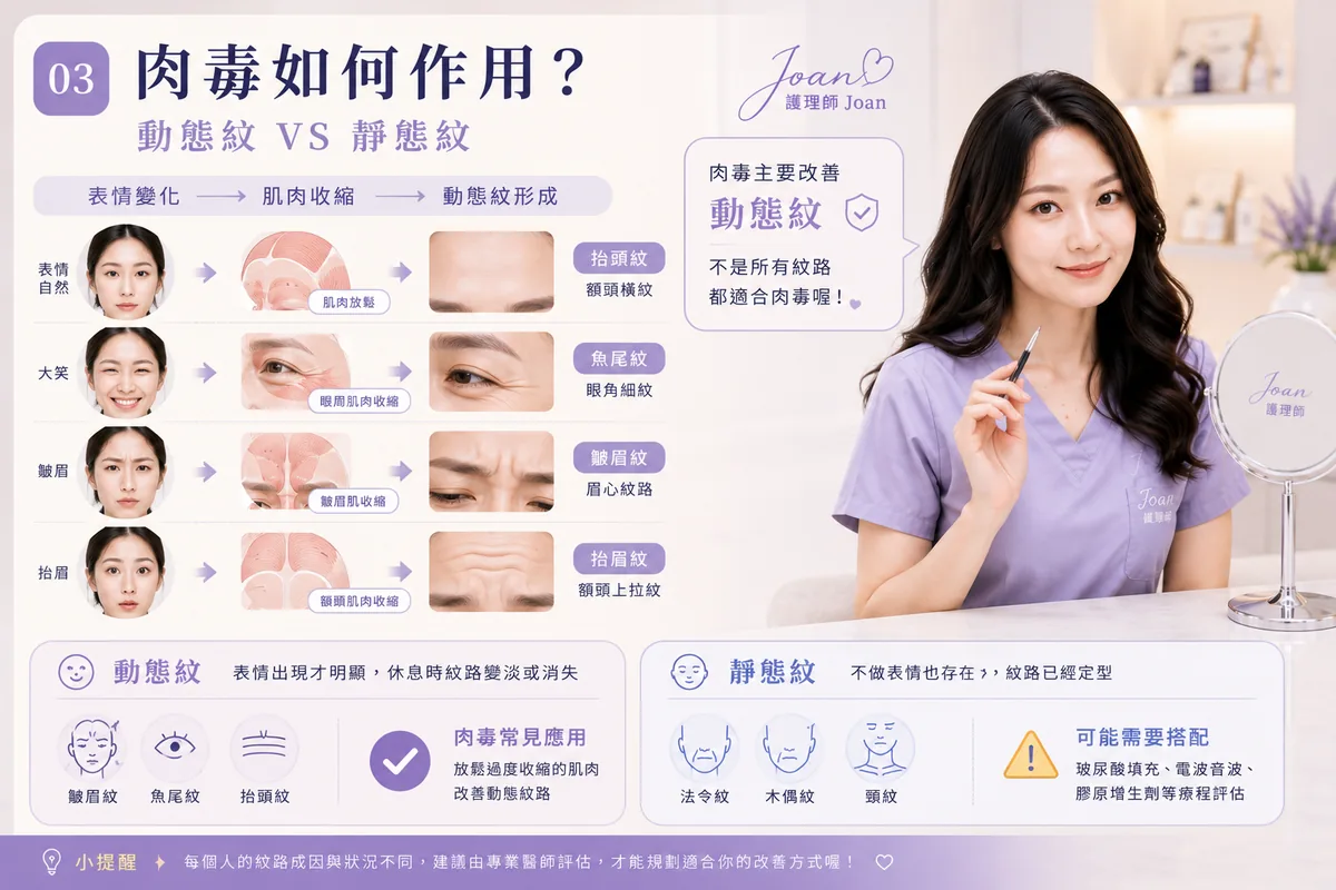 前言:肉毒是醫美入門,但不是隨便入門 圖片 05